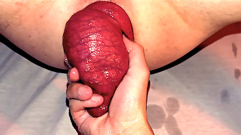 Arty Boer and Prolapsiboy.