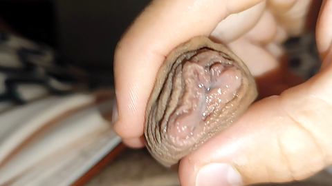 Silent Purge of Straight Scrotal Fluid.