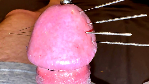 Needles Through the Thick, Hard Glans, Mega Orgasm
