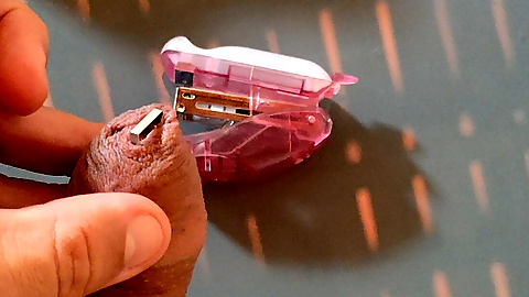 Intense Pleasure Stapling Phimosis